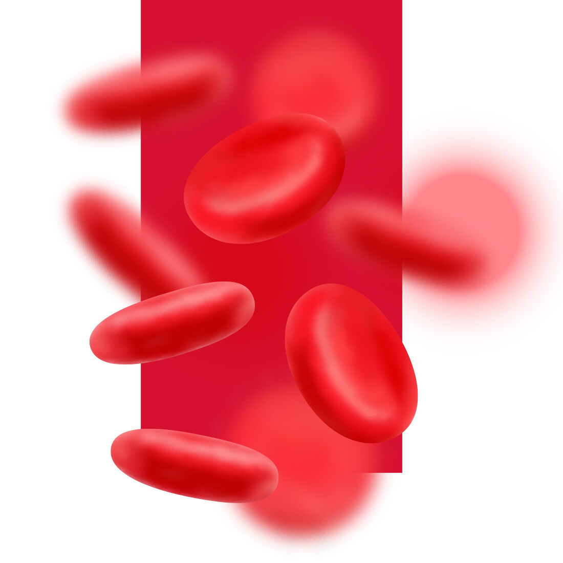 Was ist eigentlich… ein Aneurysma? :: Sander Apotheken :: dreimal in